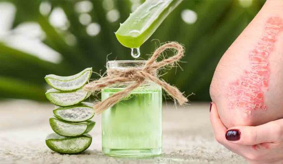 Aloe vera, risia në mjekësinë moderne