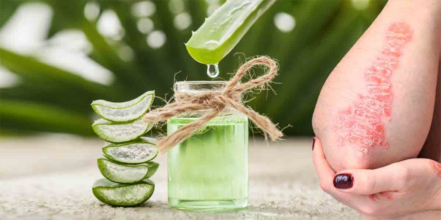 Aloe vera, risia në mjekësinë moderne