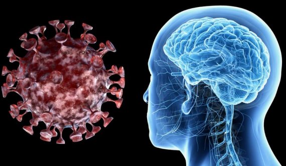  Studimi: Koronavirusi që kalon në formë të rëndë dëmton trurin dhe aftësitë njohëse 