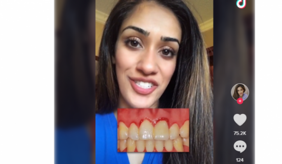 Habit studentja e stomatologjisë: Shtatzënia dihet duke shikuar në gojë