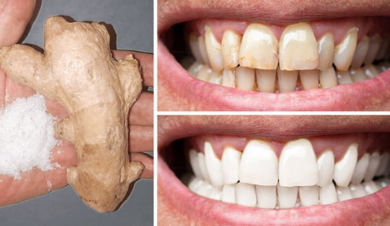 Mënyra natyrale për t’i zbardhur dhëmbët tuaj 