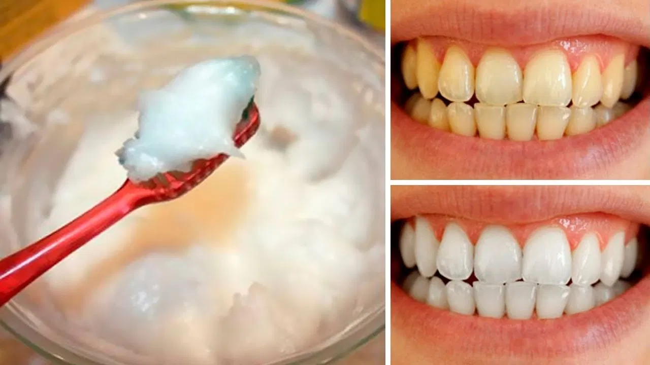 Zbardhni dhëmbët dhe shkatërroni bakteret në gojë me vetëm një përbërës