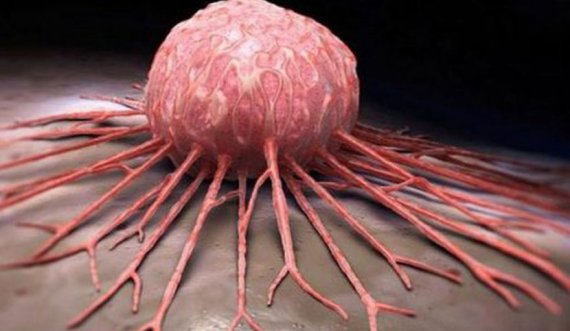Shkencëtarët zbulojnë si ta 'shkyçin' kancerin