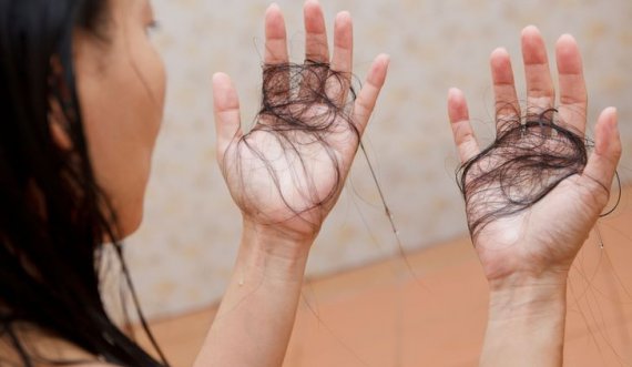 Shtatë mënyra për të kuptuar nëse po humbisni shumë flokë brenda një periudhe të shkurtër
