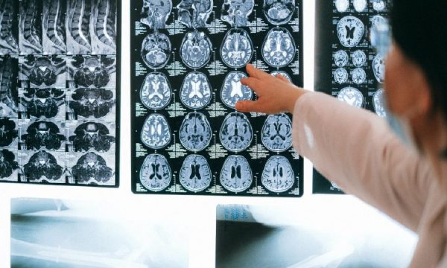  A mundet Inteligjenca Artificiale të identifikojë njerëzit që rrezikojnë të preken nga Alzheimer? 