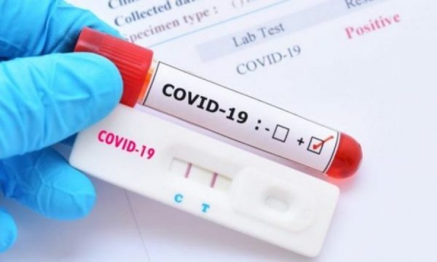 Nxënësit gjejnë tjetër mënyrë për t’i shpëtuar mësimit, krijojnë teste pozitive për koronavirus