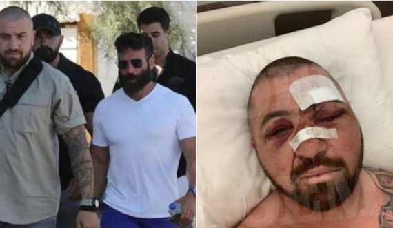 U rrah keq në Mykonos, truproja e Dan Bilzerian: Nuk kam ngrënë kurrë dru të tillë