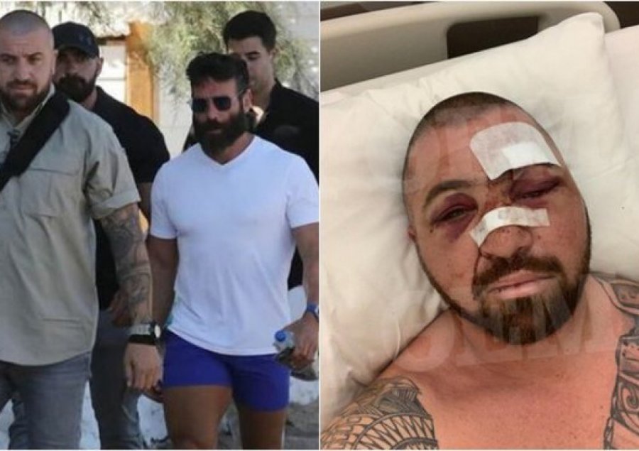 U rrah keq në Mykonos, truproja e Dan Bilzerian: Nuk kam ngrënë kurrë dru të tillë