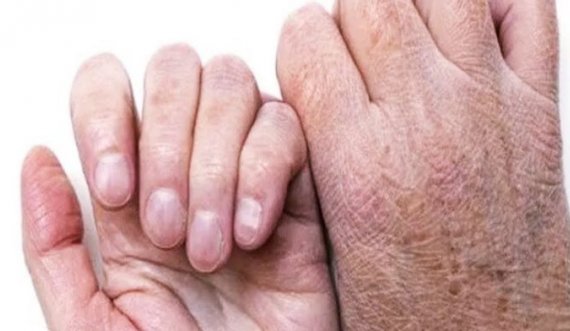 Provoni edhe ju, 6 mënyra për të trajtuar duart e thara dhe të plasaritura në shtëpi 