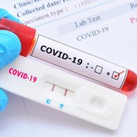 Testet e shpejta për COVID-19 fillojnë të kryhen edhe në këto 4 fshatra të Prizrenit