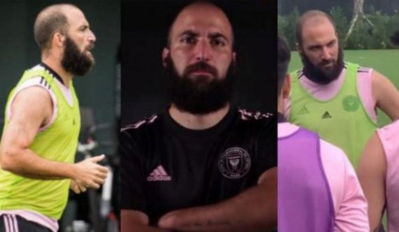 Me mjekër dhe flokë të rëna, sa shumë ka ndryshuar Gonzalo Higuain