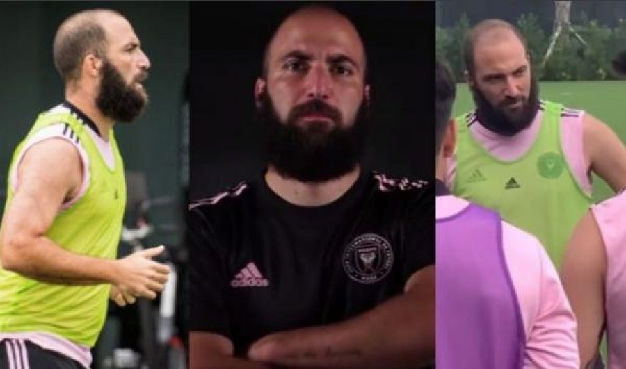 Me mjekër dhe flokë të rëna, sa shumë ka ndryshuar Gonzalo Higuain