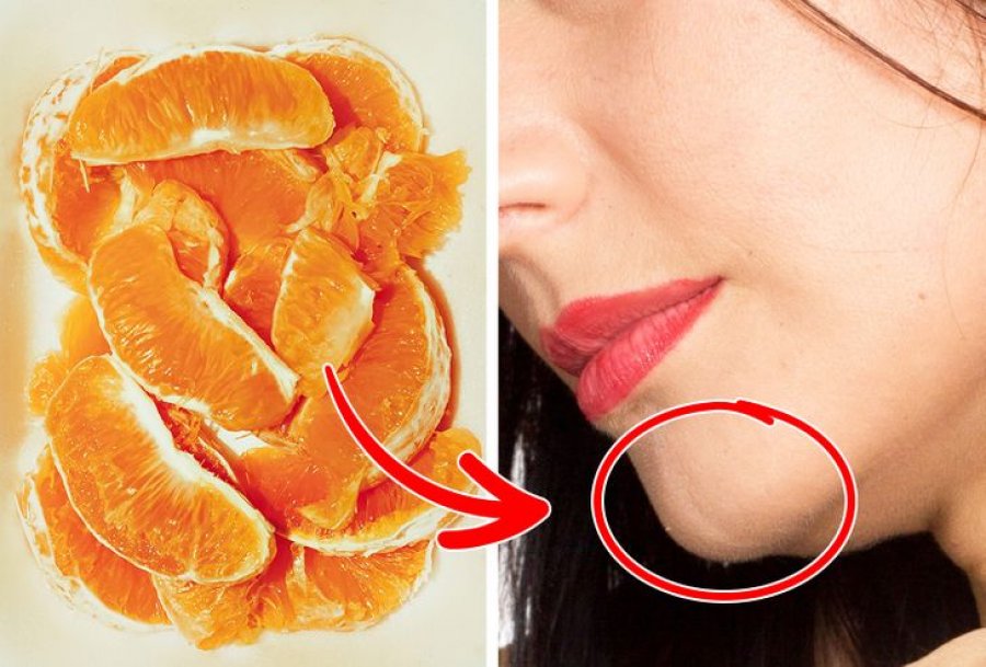 Nga veza tek portokalli, këto përbërës do t’i zhdukin një herë e mirë qimet nga fytyra juaj