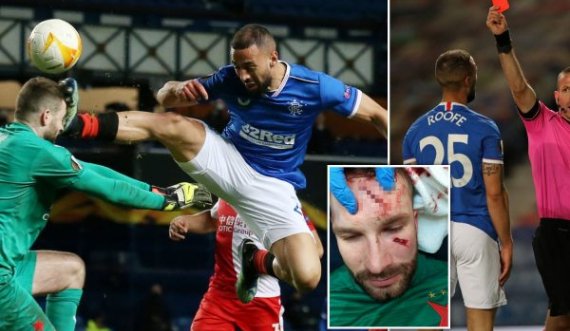 Ndërhyrja prej “killeri” e sulmuesit të Rangers, portieri i Slavias frakturë në kafkë