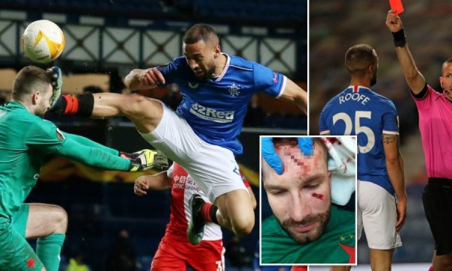Ndërhyrja prej “killeri” e sulmuesit të Rangers, portieri i Slavias frakturë në kafkë