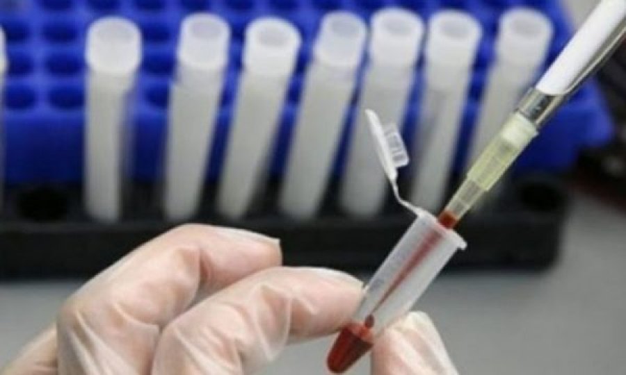  411 raste të reja me tuberkuloz janë regjistruar në Kosovë vitin e kaluar 