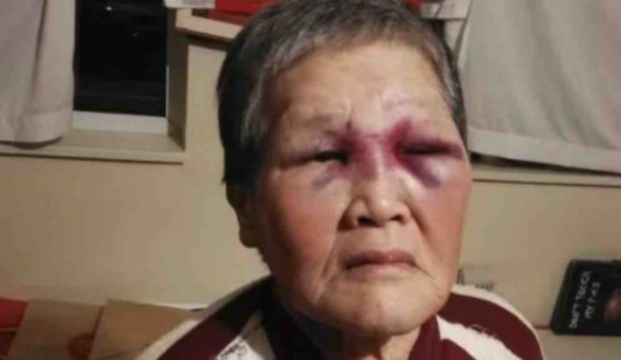  U sulmua në rrugë, gjyshja 75 vjeçare do të dhurojë 1 milion dollarë për të luftuar racizmin 