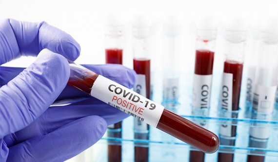  A u krijua koronavirusi në laborator? Flet mjeku shqiptar që jeton në SHBA 