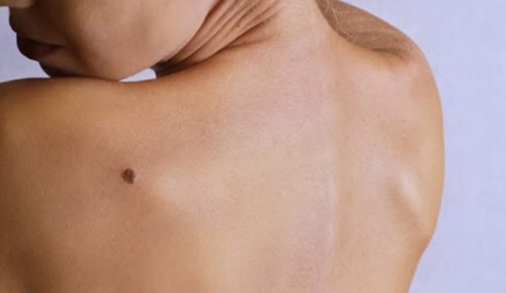 Keni nishane?Lexoni fatin tuaj