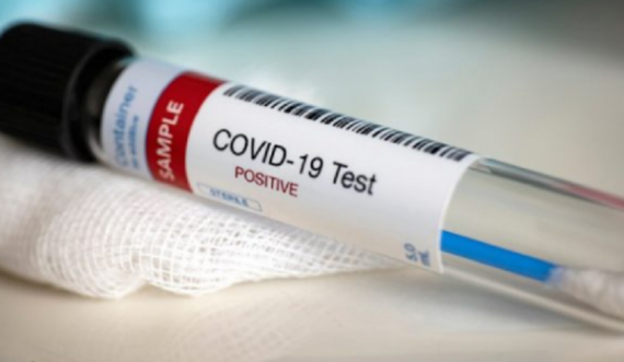 Përkundër masave, Rusia me rekord viktimash nga koronavirusi