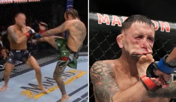 Shikoni një ndër nokautet më brutale në UFC, fytyra e Frankie Edgar u deformua plotësisht prej shqelmit të Marlon Veras