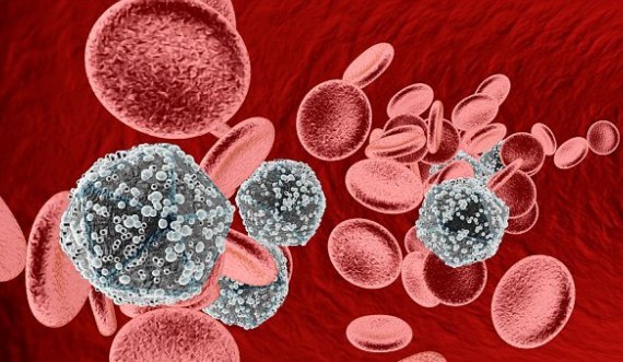 Shkencëtarët: Një person është shëruar nga virusi HIV pa mjekim