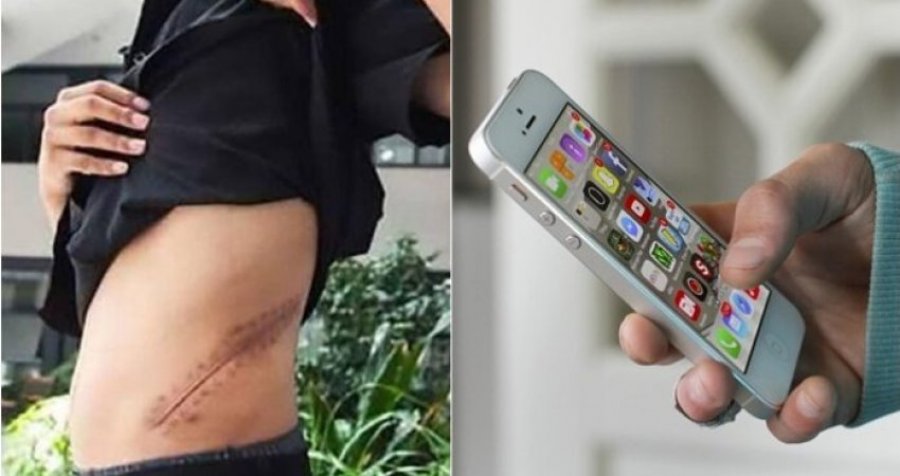 “Çka më duhen dy veshkat”, 17 vjeçari shet veshkën për të blerë iPhone-in e fundit