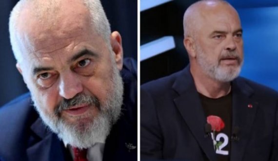 Edi Rama bën botoks? (Foto)