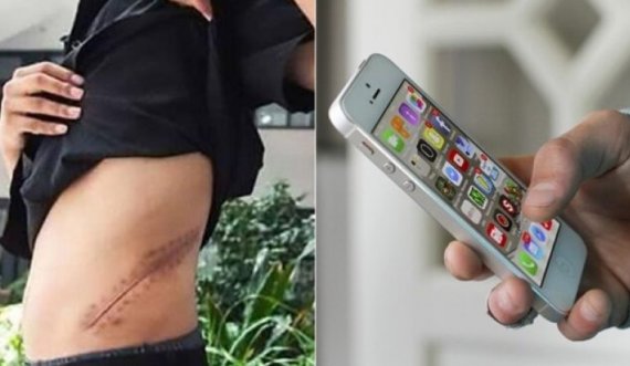 'Çka më duhen dy veshkat', 17 vjeçari shet veshkën për të blerë iPhone-in e fundit