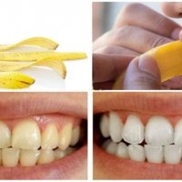 Bananet japin një buzëqeshje të bardhë!