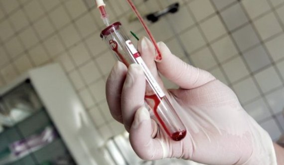 Rritet numri i të infektuarve me HIV/AIDS në Kosovë