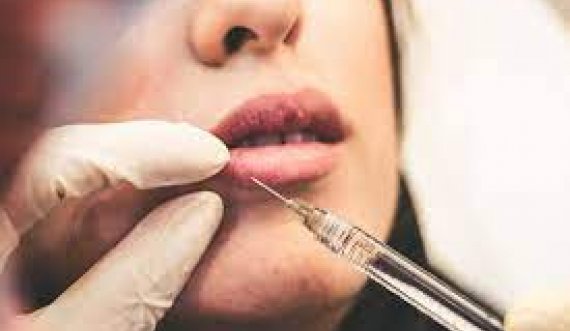 Anglia ndalon injeksionet e botoksit dhe mbushjet e buzëve për personat nën 18 vjeç