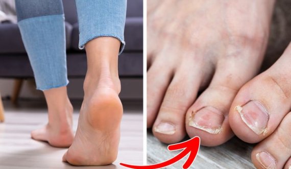 Nga aroma e pakëndshme e këmbëve deri tek infeksionet, ja pse nuk duhet të ecni kurrë zbathur