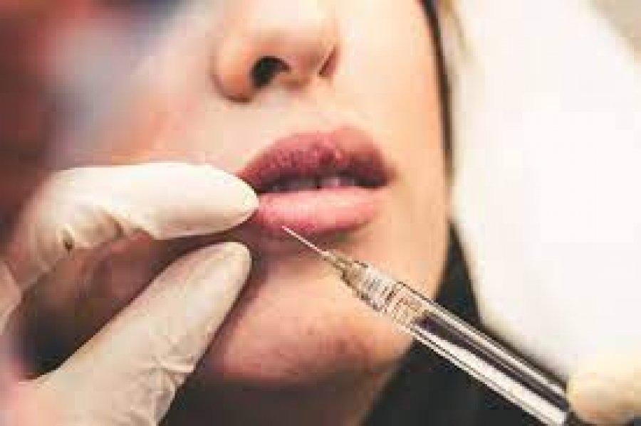 Anglia ndalon injeksionet e botoksit dhe mbushjet e buzëve për personat nën 18 vjeç