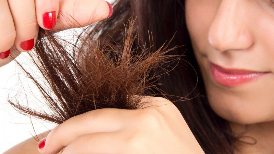 Çfarë mund të kuptoni nga majat e djegura të flokëve