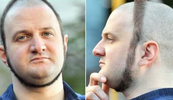 Habit me modelin e çuditshëm të flokëve, por pas fshihet një gjest prekës
