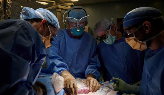 Testohet me sukses në gruan e vdekur transplantimi i veshkës së derrit