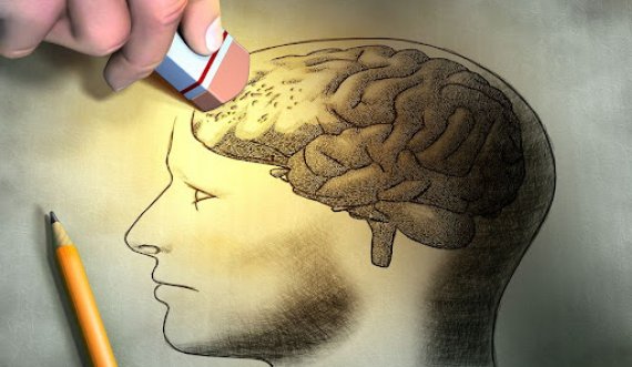 Shkencëtarët zbulojnë se si zhvillohet sëmundja Alzheimer në tru