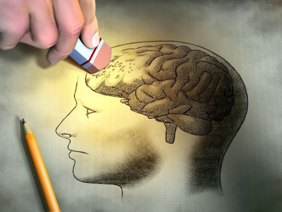 Shkencëtarët zbulojnë se si zhvillohet sëmundja Alzheimer në tru