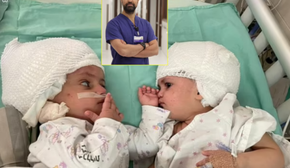  Mjeku ndan dy binjaket që ishin të ngjtura në koka 