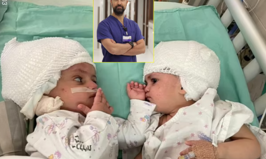  Mjeku ndan dy binjaket që ishin të ngjtura në koka 