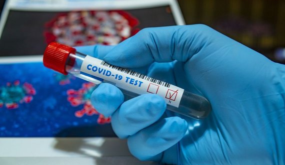 Shifra rekord infektimesh me COVID/ Një në katër të testuar rezulton pozitiv