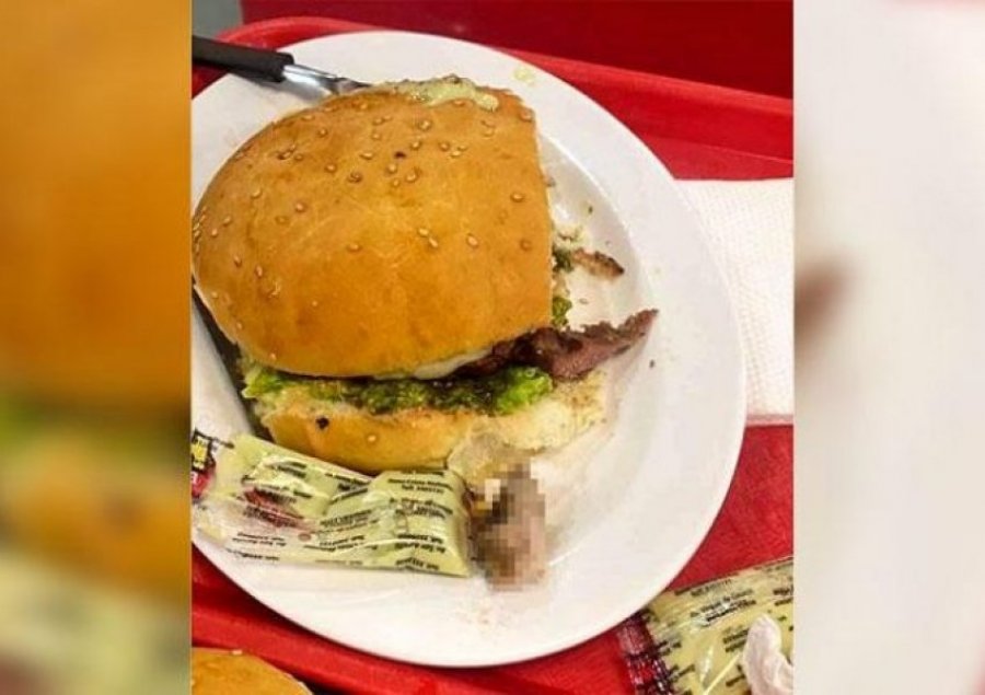 Një grua gjen gishtin e njeriut në hamburger, policia nis hetimet    