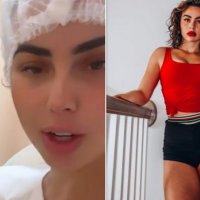 E zhveshur para kamerave, Linda Halimi publikon fotografi nga momenti i ndërhyrjes që ka bërë për heqjen e dhjamit