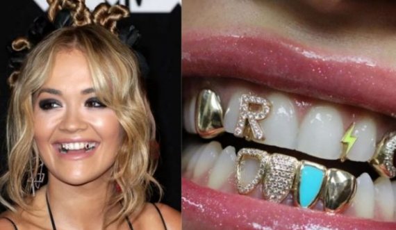 Rita Ora mbulon dhëmbët me ari dhe gurë të çmuar për “MTV VMA”