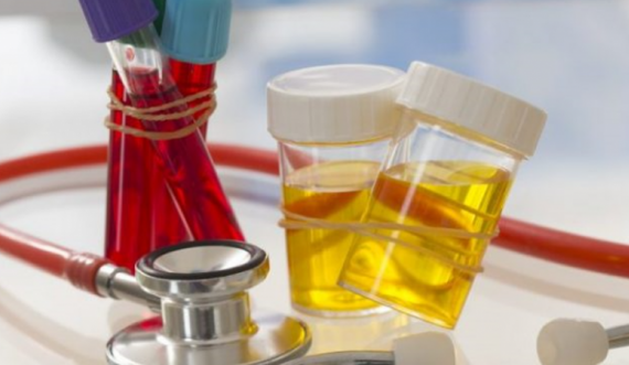 Më i rrezikshëm se kolesterina dhe sheqeri: Ky acid shkatërron në heshtje organet