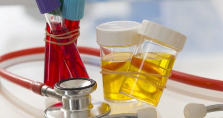 Më i rrezikshëm se kolesterina dhe sheqeri: Ky acid shkatërron në heshtje organet