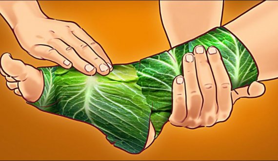 4 efektet çudibërëse nëse vendosni gjethe lakre tek kyçet e këmbëve
