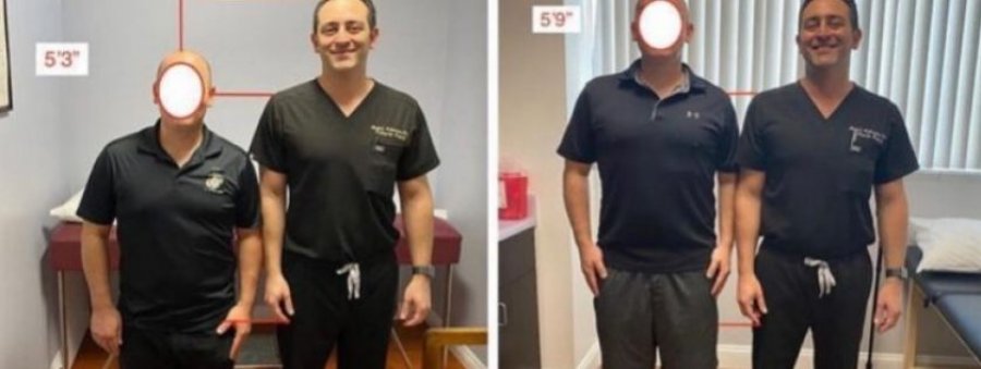 Operacioni që ju bën më të gjatë 12 centimetra