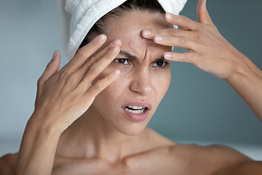 Keni probleme me lëkurën tuaj? Ja si stresi dhe ankthi ndikojnë në përkeqësimin e saj dhe si të gjeni “shpëtim”